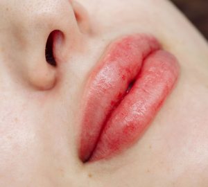 trucco permanente alle labbra, labbra dopo il trattamento