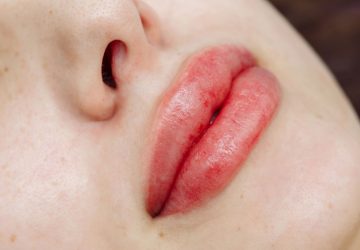 trucco permanente alle labbra, labbra dopo il trattamento