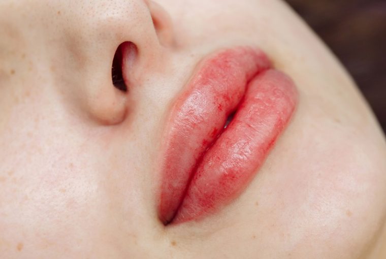 trucco permanente alle labbra, labbra dopo il trattamento
